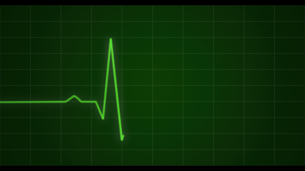 EKG from personal injury